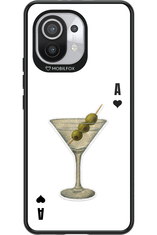 MartiniAce - Xiaomi Mi 11 5G