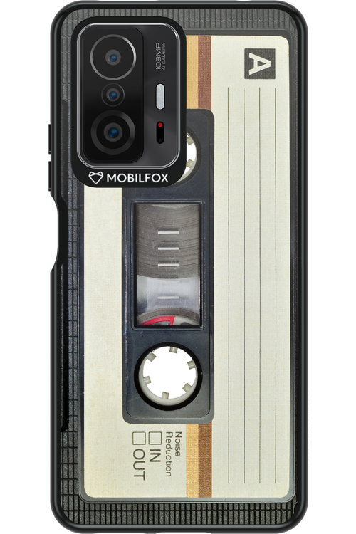 CASE 11 - Xiaomi Mi 11T Pro