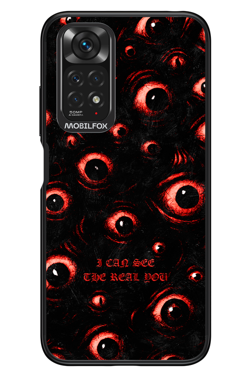 The Watchers - Xiaomi Redmi Note 11/11S 4G