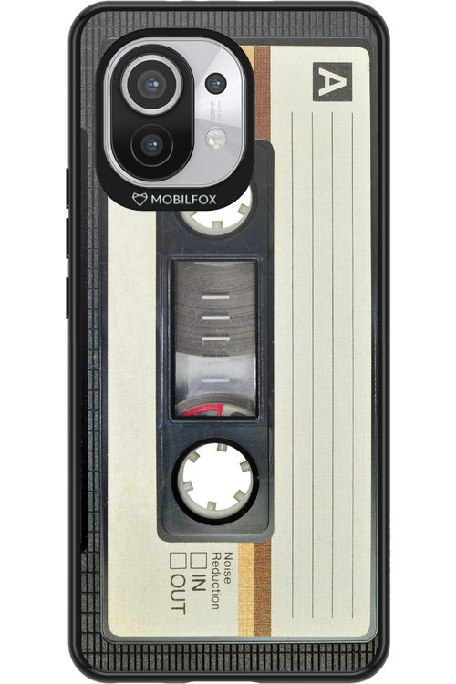 CASE 11 - Xiaomi Mi 11 5G