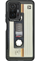 CASE 11 - Xiaomi Mi 11T