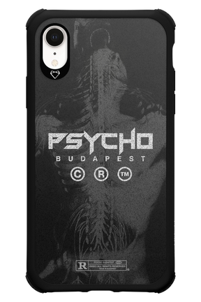 X-Ray - Apple iPhone XR