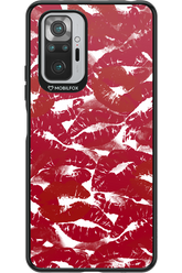 Burgundy and Kiss - Xiaomi Redmi Note 10S
