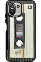 CASE 11 - Xiaomi Mi 11 Lite (2021)