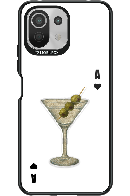 MartiniAce - Xiaomi Mi 11 Lite (2021)