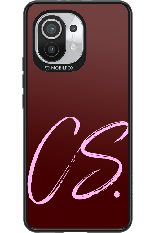 (Dark Blush) CS 2.0 - Xiaomi Mi 11 5G