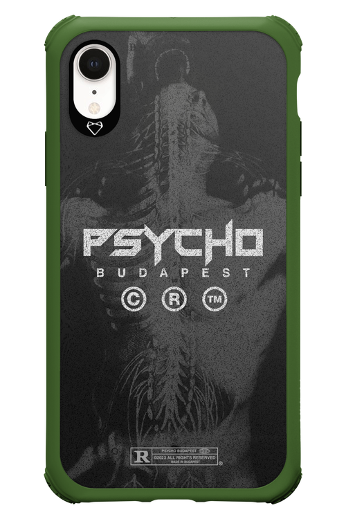 X-Ray - Apple iPhone XR