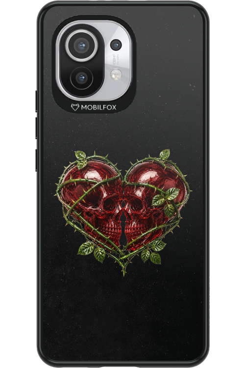 Omen Kiss 2.0 - Xiaomi Mi 11 5G