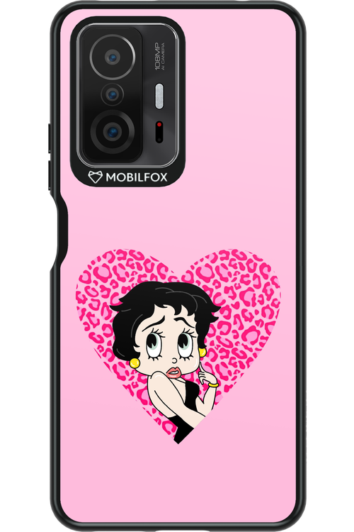 Not Betty Heart - Xiaomi Mi 11T