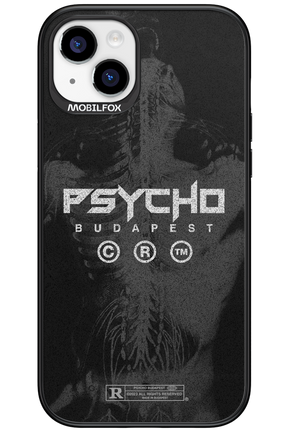 X-Ray - Apple iPhone 15 Plus