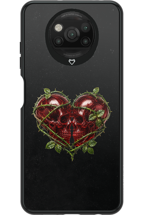 Omen Kiss 2.0 - Xiaomi Poco X3 Pro