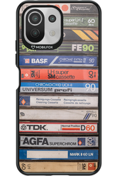 Retro Vibes - Xiaomi Mi 11 Lite (2021)