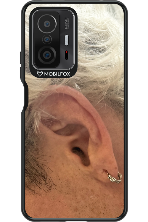 Ear 2.0 - Xiaomi Mi 11T