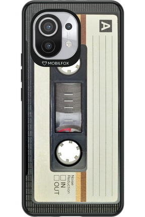 CASE 11 - Xiaomi Mi 11 5G