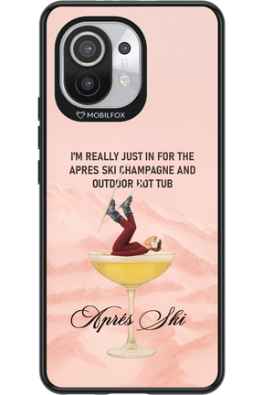 Champagne Tub - Xiaomi Mi 11 5G