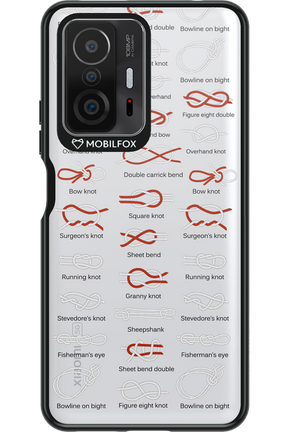 Knot Master 2.0 - Xiaomi Mi 11T