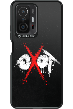 EXOT BLACK 2.0 - Xiaomi Mi 11T Pro