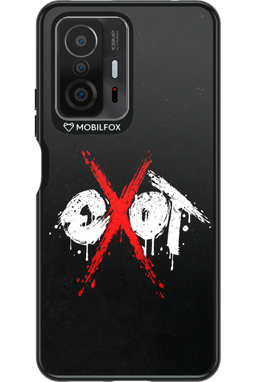 EXOT BLACK 2.0 - Xiaomi Mi 11T Pro