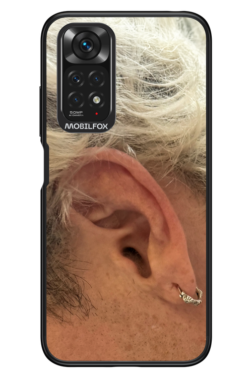 Ear 2.0 - Xiaomi Redmi Note 11/11S 4G