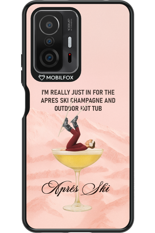 Champagne Tub - Xiaomi Mi 11T Pro