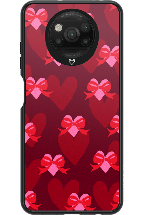 My Heart My Love - Xiaomi Poco X3 NFC