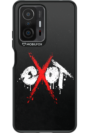 EXOT BLACK 2.0 - Xiaomi Mi 11T