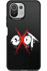 EXOT BLACK 2.0 - Xiaomi Mi 11 Lite (2021)