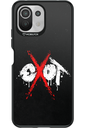 EXOT BLACK 2.0 - Xiaomi Mi 11 Lite (2021)