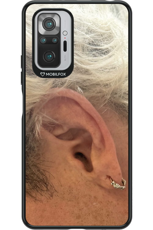 Ear 2.0 - Xiaomi Redmi Note 10S