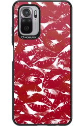 Burgundy and Kiss 2.0 - Xiaomi Redmi Note 10
