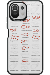 Knot Master - Xiaomi Mi 11 Lite (2021)