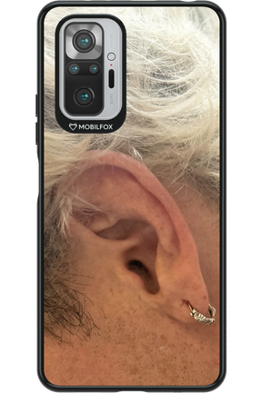 Ear 2.0 - Xiaomi Redmi Note 10 Pro