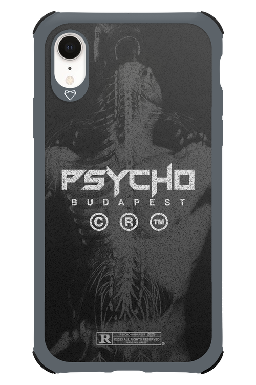 X-Ray - Apple iPhone XR